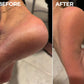 Pedicure 3.0 - Callus Remover